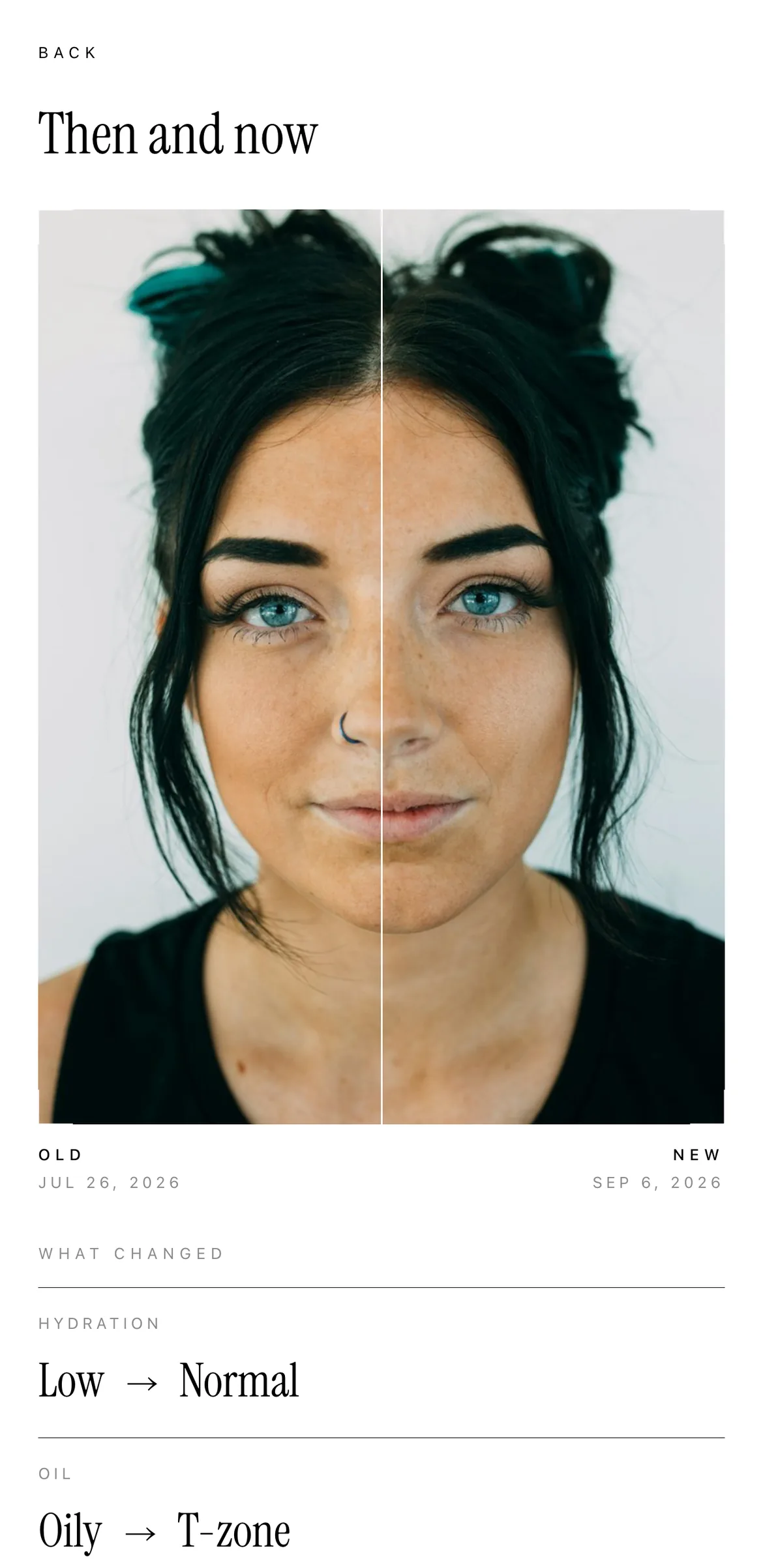 The Boirelle compare screen: two scans of the same face split by a vertical slider, dated old and new, above a list of readings that changed.